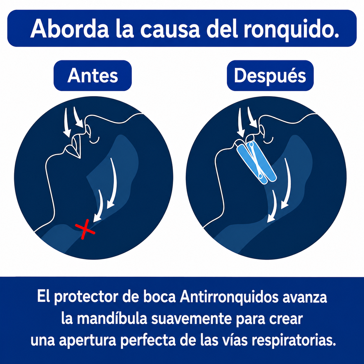 Protector bucal anti-ronquidos